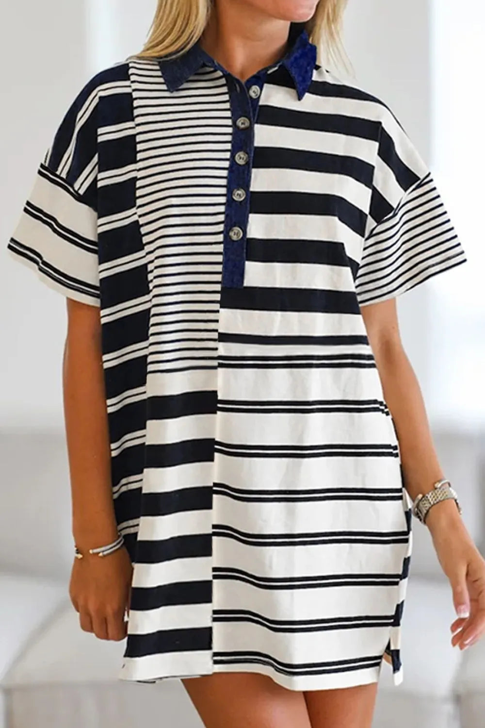 Button Detail Striped Short Sleeve Mini Dress
